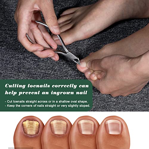 FVION Nagelzange Eckenzange Gerade Klinge - Nagelzangen für Eingewachsene Fußnägel und Fingernäge, Scharfe Spitze und Edelstahl für Starke Fußnägel 2