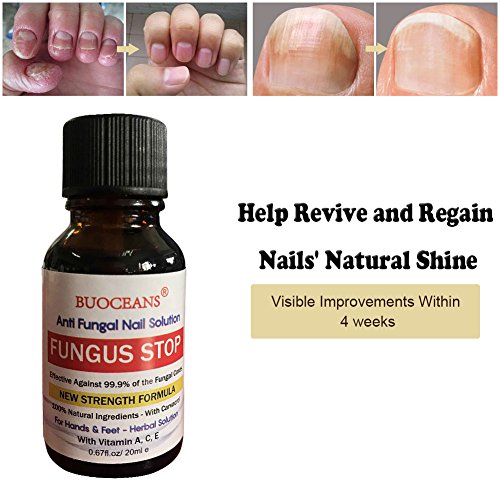 Fungus Stop, Fungal Nail Oil, Anti Fungus Nail Treatment, Effective against nail fungus, Anti