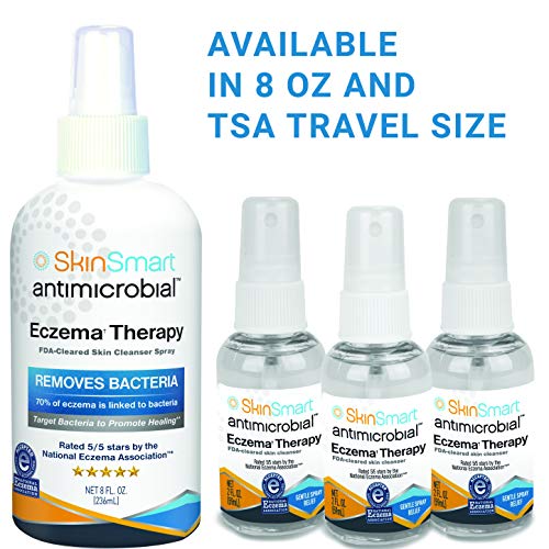 SkinSmart Eczema Therapy Removes Bacteria so Skin Can Heal, 8 Ounce Clear Spray and Safe for Babies, Kids, Adults and Seniors