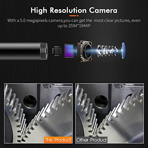 Endoscope Zoto at Harland Sarmiento blog