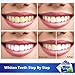 MayBeau Teeth Whitening Strips, 56 Packs 3D Teeth Whitening Kits Gentle Teeth Whitener Whitestrips for Sensitive Teeth, Dental Bleaching Treatment for Teeth Whitening Stain Removal