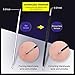 Blackhead Remover Tweezer Kit, ElleSye 3pcs Skin-safe Acne Removal Tool Set, Stainless Steel Double-ended Pimple Comedone Extractor, Whitehead Blemish Zit Removal Tool, Metal Case
