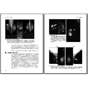 Manmogurafi gijutsuhen