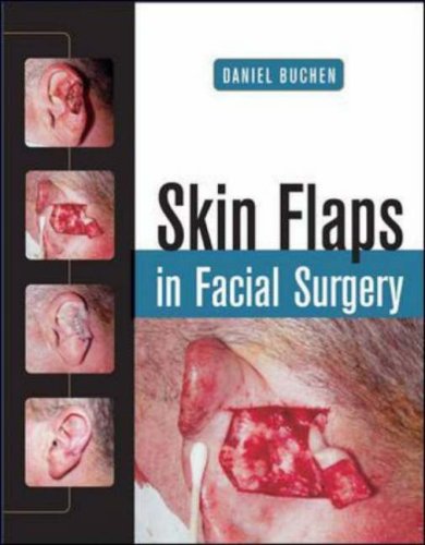 SKIN FLAPS IN FACIAL SURGERY
