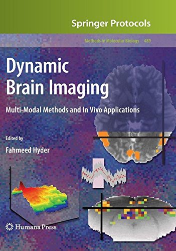 Dynamic Brain Imaging : Multi-Modal Methods and... B01IE4A48G Book Cover