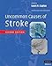 Uncommon Causes of Stroke