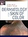 Dermatology for Skin of Color
