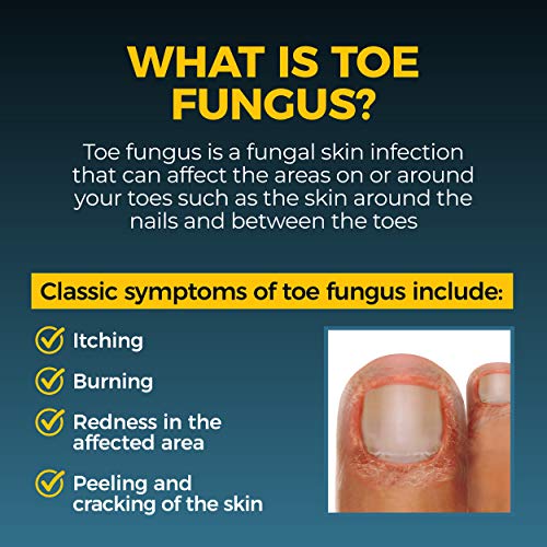 Fungi Nail AntiFungal Ointment, Kills Fungus That Can Lead to Nail