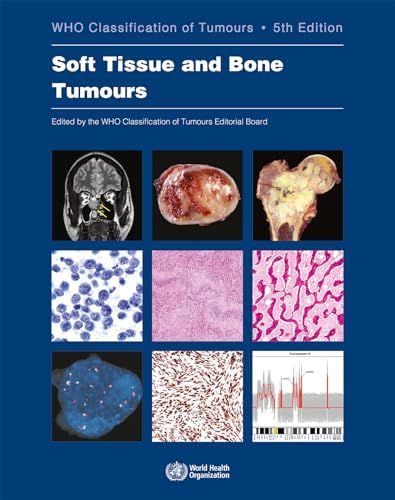 Breast Tumours: WHO Classification of Tumours (Medicine