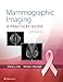 Mammographic Imaging