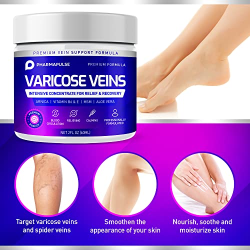 varicose vein support