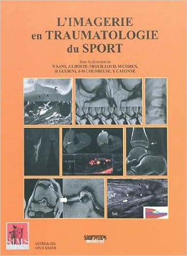 Amazon Fr L Imagerie En Traumatologie Du Sport Lhoste Trouilloud Agnes Guerini H Coudreuse J M Catonne Yves Collectif Livres