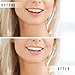 Activated Charcoal Teeth Whitening Powder - All Natural Black Charcol Toothpaste Dental Powder Safe & Gentle for Gums & Sensitive Teeth Brighter Smile Tooth 4 oz