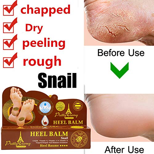 Sunshinehomely Women Hand and Foot Skin Repair, Snail Repair Cream Remove Exfoliating Feet Skin Peeling Calluses Beauty Foot Care