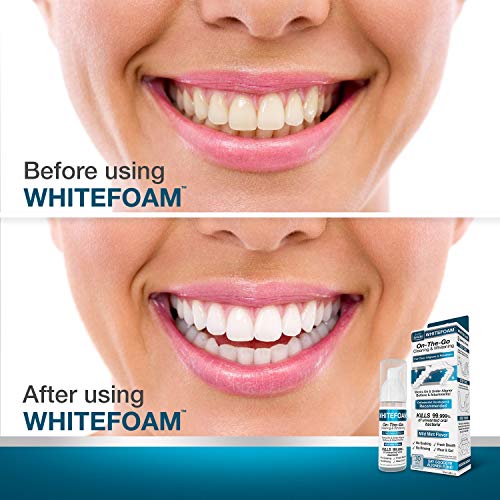 EverSmile AlignerFresh Original Clean The Original Cleaning WhiteFoam