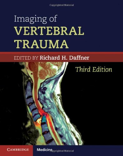 IMAGING OF VERTEBRAL TRAUMA