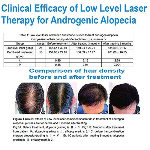 New Nodeahelmet Laser Hair Growth System, FDA Cleared 81 Diodes Hair