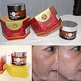 01 Boxes - Kem vua trị nám của nhật bản - Whitening Cream JAPANESE