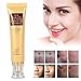 Acne Scar Removal Cream, Skin Repair Cream Scar Cream Gel Scar Treatment for Face and Body Scar Acne Spots Stretch Marks 30ml