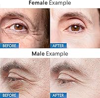 evagloss rapid reduction cream plus