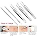 MiroPure Blackhead Whitehead & Splinter Remover