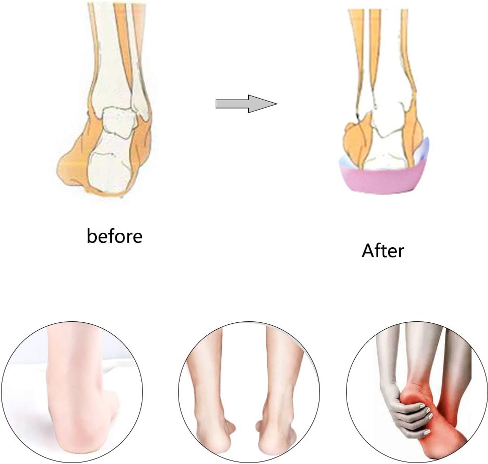 Pcssole’s 3/4 Orthotics Shoe Insoles High Arch Supports Shoe Insoles for Plantar Fasciitis, Flat Feet, Over-Pronation, Relief Heel Spur Pain  (L:Men6.5-8.5/Women7.5-9.5): Health & Personal Care