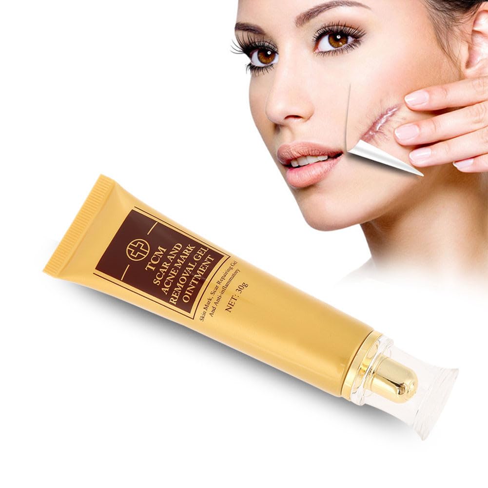 Acne Scar Removal Cream, Stretch Mark Removal Gel Face Skin Repair Cream Ointment for Old & New Scars, Acne Spots, C-Sections, Injury, Burns and Anti-inflammatory Skin Care 30g