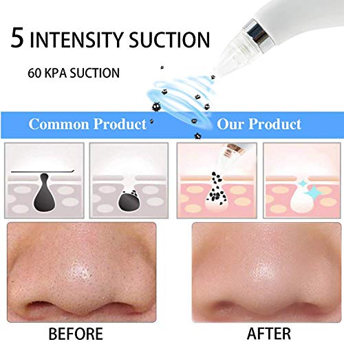 Blackhead Remover Vacuum Portable Blackhead Suction Tool with LED Display Facial Pore Cleanser Electric Acne Comedone Extractor Kit Women Christmas Gift (White)