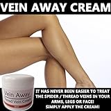 Vein Away Remove Ugly Spider / Thread Veins! Pain Free and Quick!