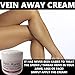 Vein Away Remove Ugly Spider / Thread Veins! Pain Free and Quick!