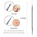 HeyBeauty Blackhead Remover Tools Kit with 10 PCS Alcohol Cotton Pads, Professional 5 in 1 Whiteheads Blemish Comedones Acne Zit Pimple Treatment Tools