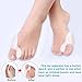 Bunion Relief & Bunion Corrector Protector Sleeves Kit - Treat Pain in Hallux Valgus, Tailors Bunion, Big Toe Straightener, Hammer Toe, Toe Separator Spacers Bunion Splint Aid Surgery Treatment Night