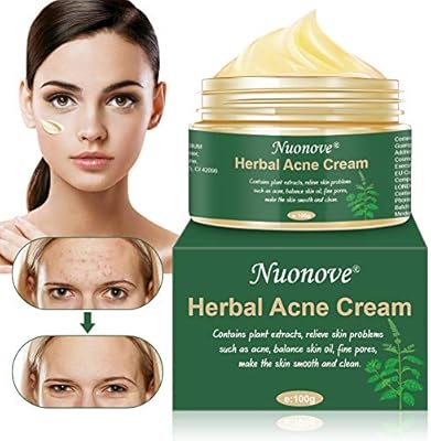 amazon acne cream