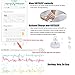 SLEEPON Sleep Monitor, Helps Detect Sleep Abnormalities - Family Sleeping Health Tracker with Heart Rate, Blood Oxygen Saturation, Breathing Tracking and A Real-Time Low Oxygen Alert for iPhone 5 678X