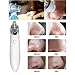 PowMax Blackhead Remover,Rechargeable Electronic Acne Remover Facial Pore Cleaner Utilizes Pore Vacuum Extraction-White