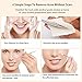 Blackhead Acne Remover Kit, Aooher 9pcs Stainless Steel Blemish and Comedones Extractor Tool Set for Treating Blackhead Whitehead Acne Pimples