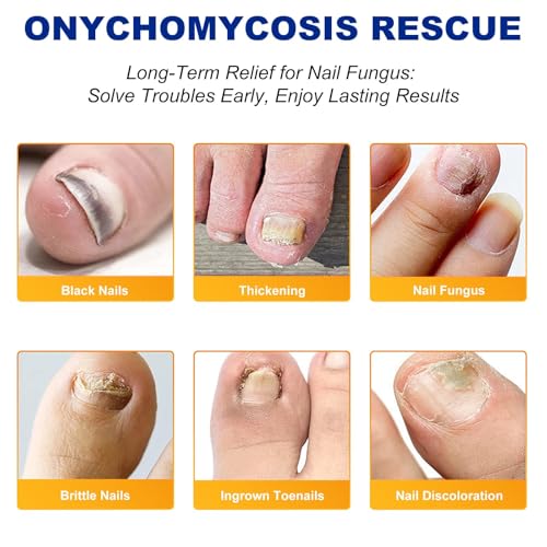 Lboylove® 32 Pcs Fungal Nail Patches, Nighttime Toenail Fungus Treatment, 8-Hour Overnight Repair, Anti Repair And Strengthen, Suitable For Men Women