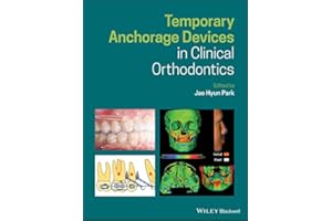 Temporary Anchorage Devices in Clinical Orthodontics