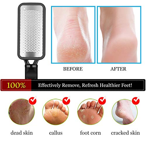 image for Antonki Colossal Foot Scrubber Foot File Useful Professional Pedicure 