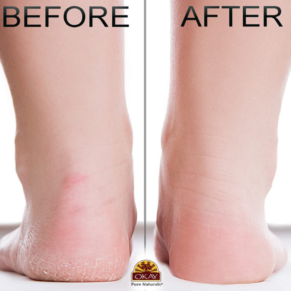 Okay **ALL NATURAL** Mango Butter Foot Scrub 6oz / 177ml