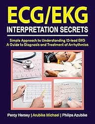 ECG/EKG INTERPRETATION SECRETS: Simple Approach to
