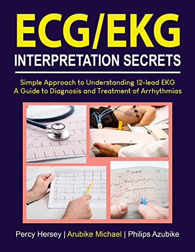 ECG/EKG INTERPRETATION SECRETS: Simple Approach to