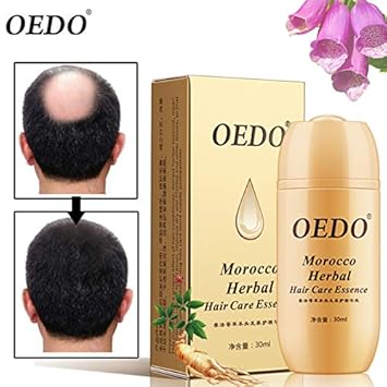 Buy Royal Beauty 30ml Moroccan Hair Loss Treatment Ginseng Ginger