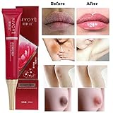 Hometom Pink Nipple Cream Underarm Pinken Whitening Lightening Bleaching Armpit Dark Skin (15ml)