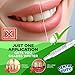 Teeth Whitening Gel Refills, 36% Carbamide Peroxide, Made in USA, Whitening Gel for Trays, 4X 5mL Teeth Whitening Syringes, Faster & More Effective Than Strips, 60 Treatments