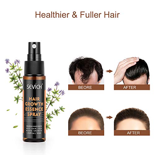 Hair Regrowth Spray, Anti Hair Loss, Thinning, Balding, Natural Ingredients Hair Regrowth Treatment for Stronger, Thicker, Longer Hair Grow,Repair Hair Follicles, All Hair Types, Men and Women