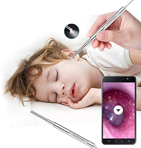 ScopeAround Ear Wax Removal Endoscope