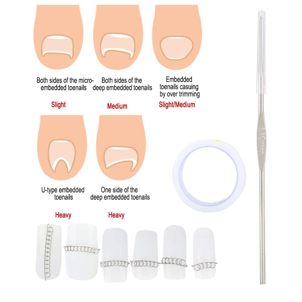 Sala Ctr 3pcs Ingrown Toenail Correction Pedicure Recover Set