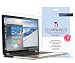 iLLumiShield - Toshiba Satellite Radius 15.6" Screen Protector (2015) w/ HD Blue Light UV Filter & Lifetime Warranty/Clear Film/Anti-Fingerprint/Anti-Bubble/Invisible Shield [1-Pack] Only P55W-B5112
