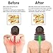 Maldora Cervical Neck Traction Device for Instant Neck Pain Relief ✮ Inflatable & Adjustable Neck Stretcher Pillow for Home Traction Spine Alignment (Grey) ✮ FDA Registered ✮ Bonus Sleep Mask